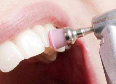 بروساژ دندان چیست و چگونه انجام می گردد؟