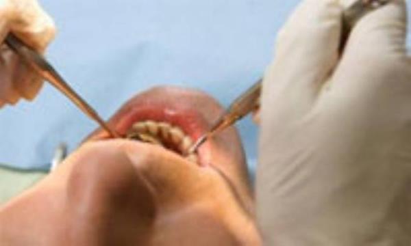 سین جیم های رایج دندان پزشکی